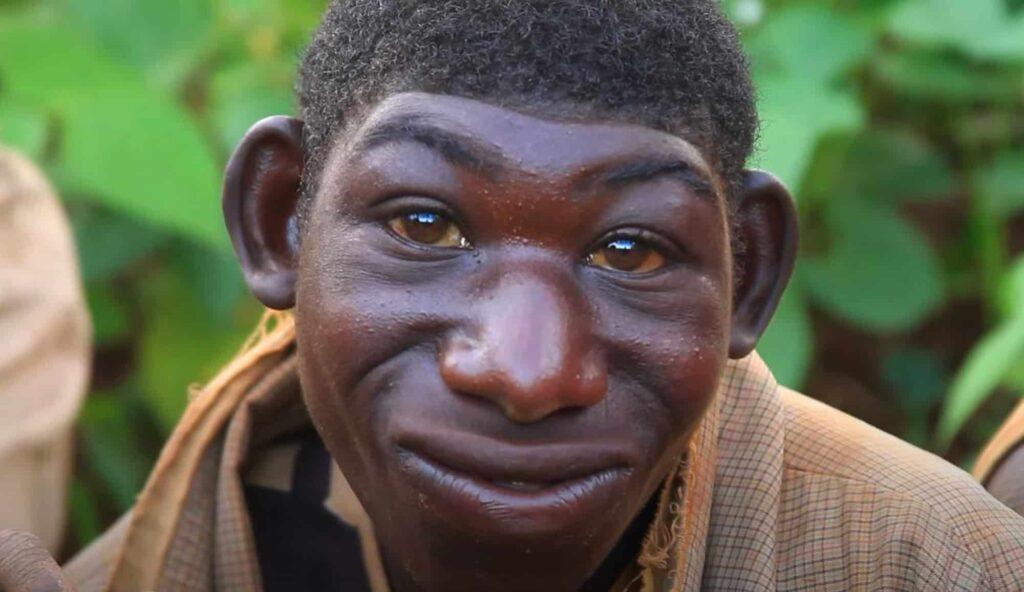 Vivió en la selva de Ruanda durante años para huir de las burlas en la escuela por su apariencia