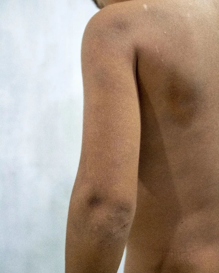 Rescatan a niño que fue raptado para someterlo a trabajo forzoso en una finca en Zulia