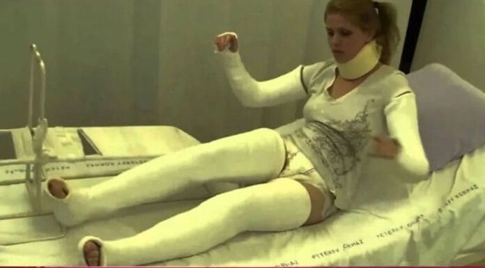 Esta mujer tuvo tres fracturas tras intentar el reto sexual de «la araña», conozca de que se trata