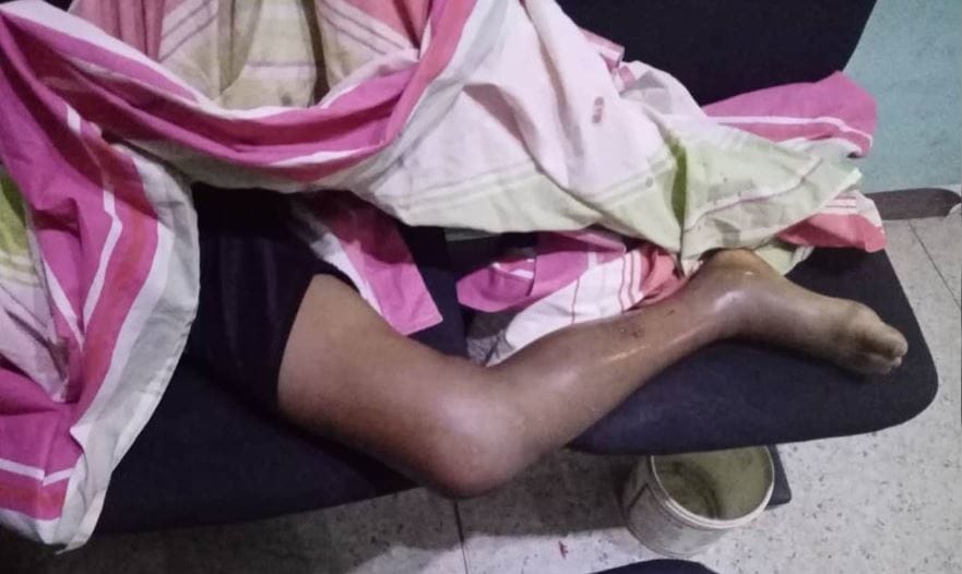 Niño fue mordido por una serpiente rabo amarillo en Sierra de Perijá