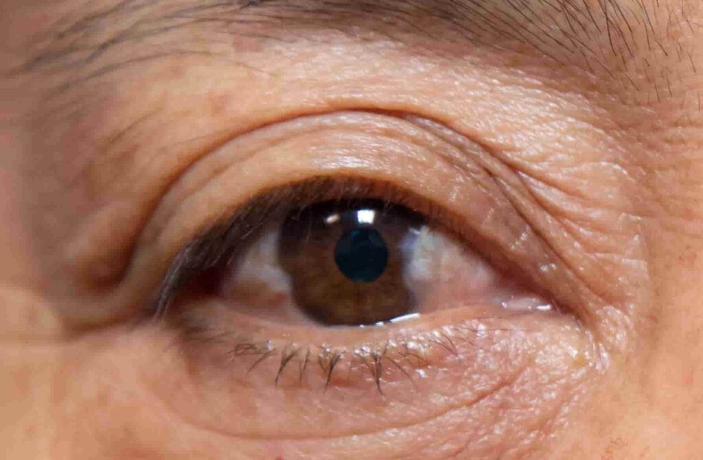 Olvídate de los ojos carnosos con estos tips 100% naturales