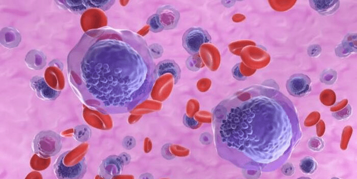 Fármaco experimental logra remitir la leucemia en 18 pacientes