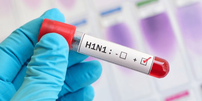 Perú detecta un brote de influenza H1N1 en Lima y otras regiones