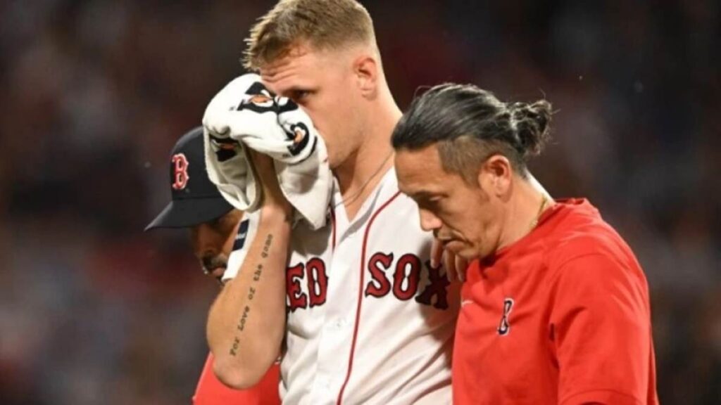 ¡TREMENDO GOLPE! Pitcher de Medias Rojas recibió un duro pelotazo en el rostro que lo dejó con terrible fractura (Video)