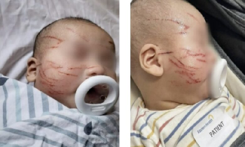 Madre desesperada arremete contra guardería luego que rasguñaran la cara de su bebé más de 20 veces (Imágenes sensibles)