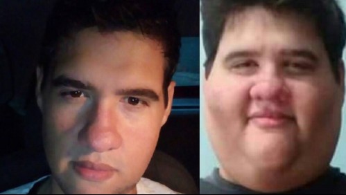 Murió de un paro cardiopulmonar «influencer» brasileño que adelgazó casi 200 kg