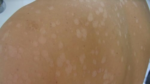 Piel