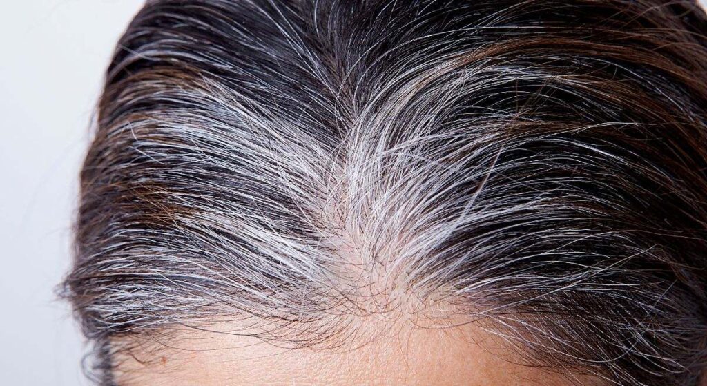 Canas