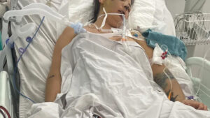 coma inducido