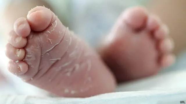 ¡TRAGEDIA! Bebé de 3 meses pierde la mitad de su cráneo luego de que su niñera le cayó encima estado del bebé Braxton Musselman