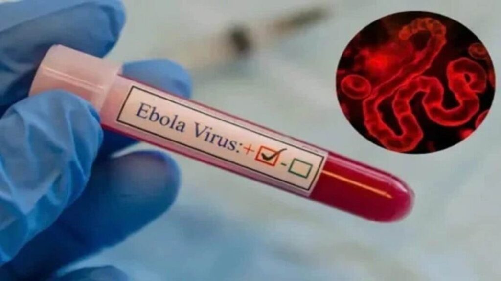 cerco epidemiológico en aeropuertos