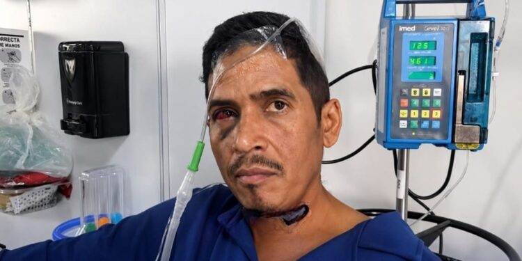 Hernán Gil fue el último milagro de los rescatados bajo los escombros tras terremotos en Venezuela terremoto en Venezuela 2026